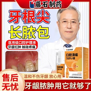 牙根尖牙龈脓包肿痛肿胀鼓包消炎专牙根发炎用止痛喷剂药监备案EM