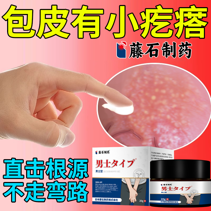 生殖器皮脂腺异位症阴茎包皮有小疙瘩阴囊白色白点脂肪颗粒水泡oz