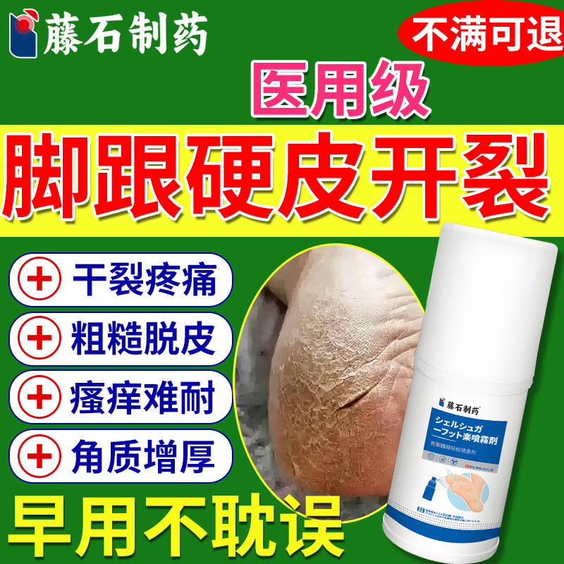 脚后跟干裂起硬皮足跟开裂脚癣癣真菌感染一次净官方旗舰店喷剂DZ
