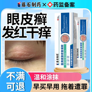 眼皮癣藓红肿痒眼睛周围眼周过敏发痒眼角干燥起皮掉屑可搭药膏OZ