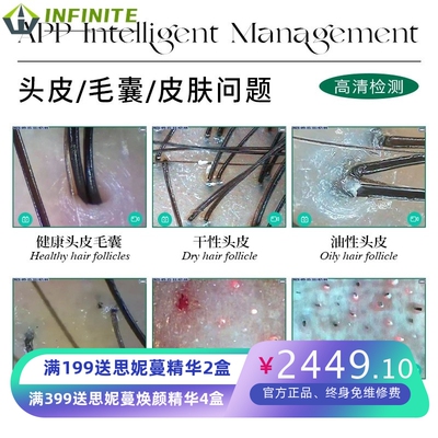 安卓头皮皮肤检测仪毛囊四光谱面部分析双探头一体机美容院脸部脸