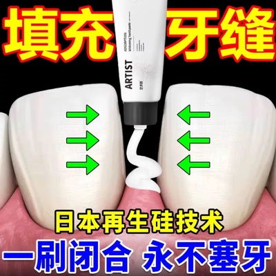 牙缝宽大修复神器补牙缝填充门牙牙缝大矫正防堵蛀牙牙洞清理
