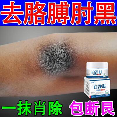白净肤胳膊手肘去死皮肤除脖子腋下黑棘色素沉淀暗沉白美膏药神器