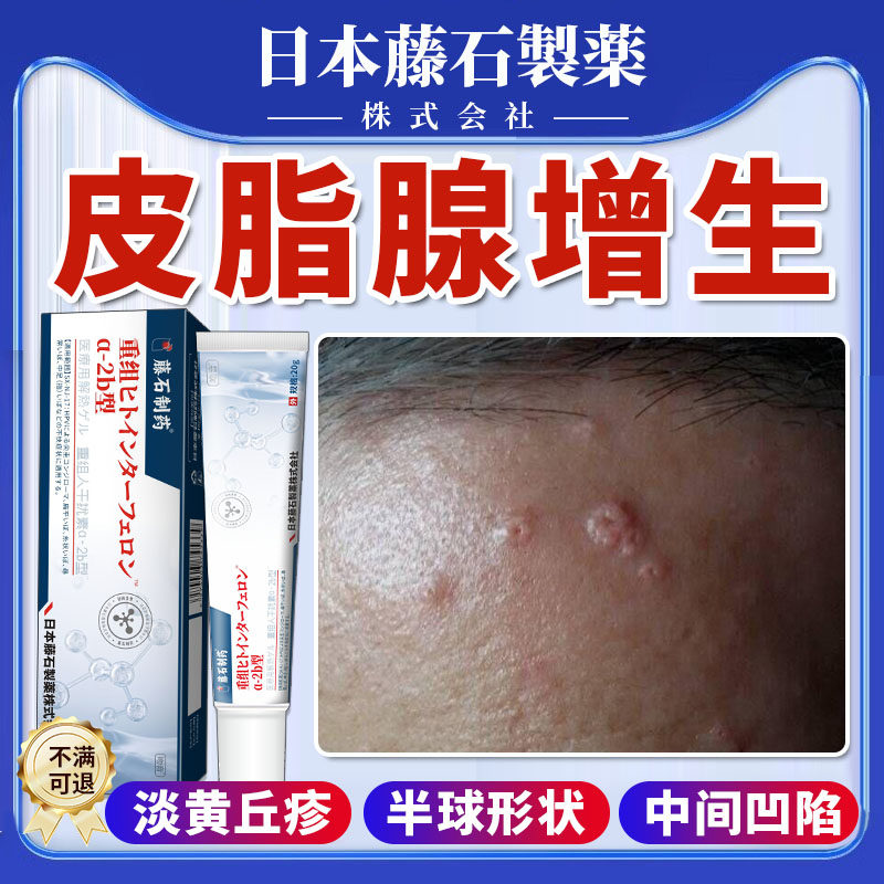 皮脂腺增生增大面部胸前囊肿丘疹肚脐样凹陷早熟性老年性小疙瘩yr