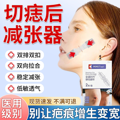 切痣后防疤痕增生变宽医用减张器