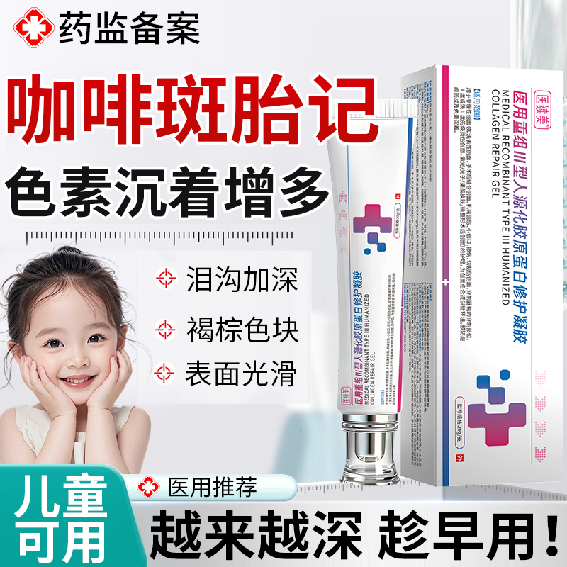 儿童咖啡斑胎记去除神器胎记膏分解咖啡斑神经性纤维瘤搭防晒贴EM