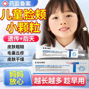 儿童毛周角化去除鸡皮改善脸部脸颊两边小疙瘩毛囊角化霜除角质EM