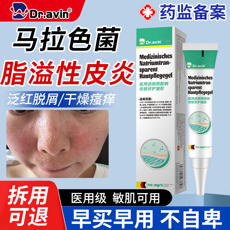 【代文】马拉色菌面部脂溢性皮炎