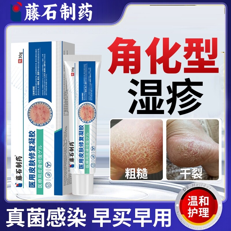角化型脚气脚后跟干裂起硬皮真菌感染开裂癣毒清膏干燥起皮OZ