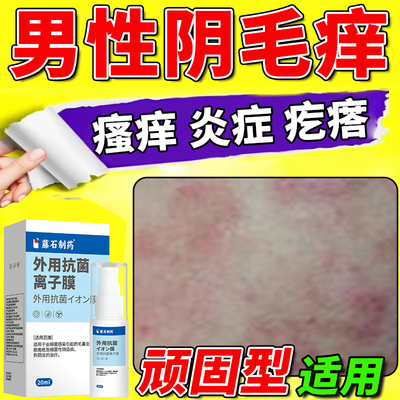 【现货速发】男性阴毛痒止痒抑菌