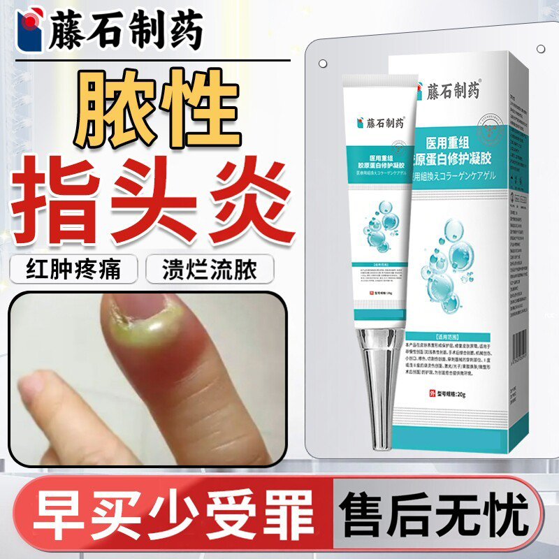 化脓性手指头炎专用手指甲边痛甲沟炎真菌感染发炎肿痛薬房同款MP