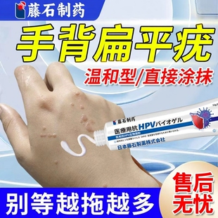 手背扁平疣专用软膏去除膏一抹灵祛疣瘊去面颈部 神器薬房同款DZ