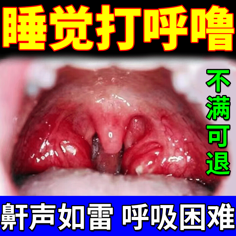 【现货速发】睡觉打呼噜不停