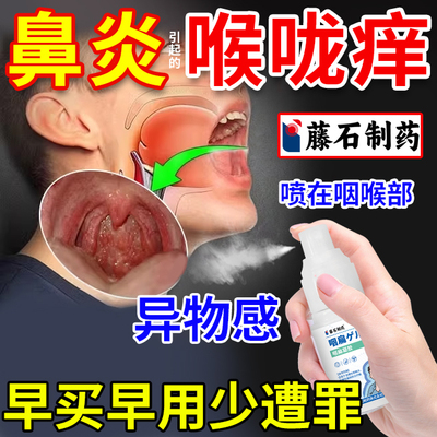 过敏性鼻炎上颚痒喉咙痒