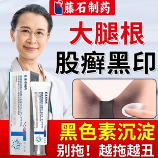 股藓癣去黑去除男士大腿内侧黑印裆部胯下发黑色素沉淀专用软膏DZ