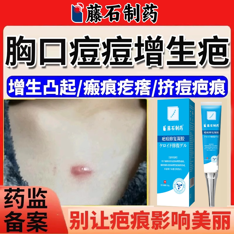 胸口前痘印痘痘增生疤痕凸起疙瘩硬肉去除医祛疤膏瘢痕贴EM