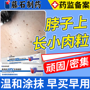 藤石制药去疣瘊脖子上长小肉粒扁平疣去除一抹疙瘩灵丝状疣软膏DZ