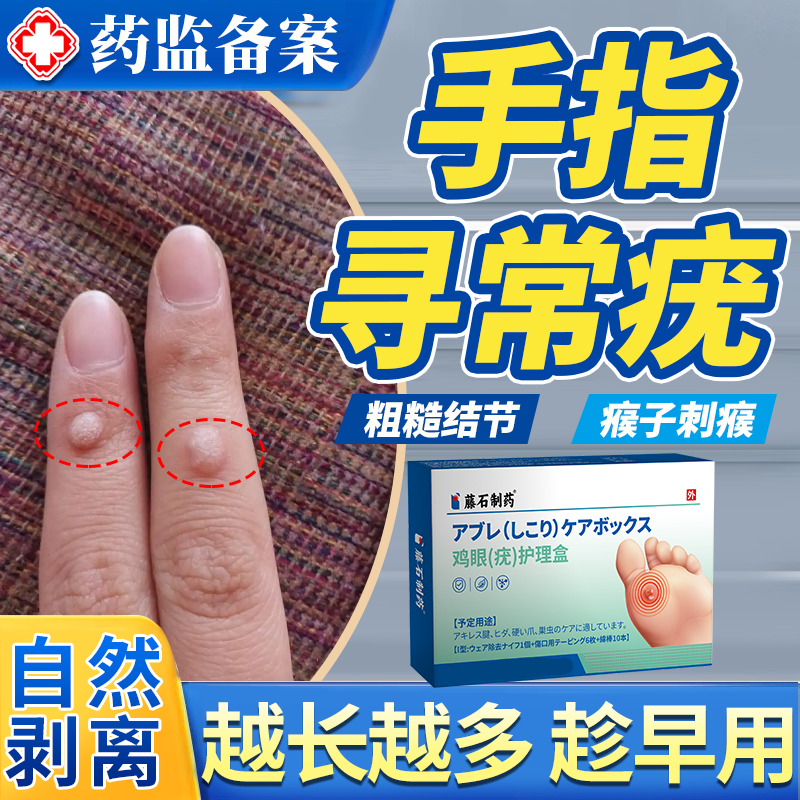 手上长硬疙瘩寻常疣膏去除甲周疣根刺猴瘊子神器薬房同款专用贴JW