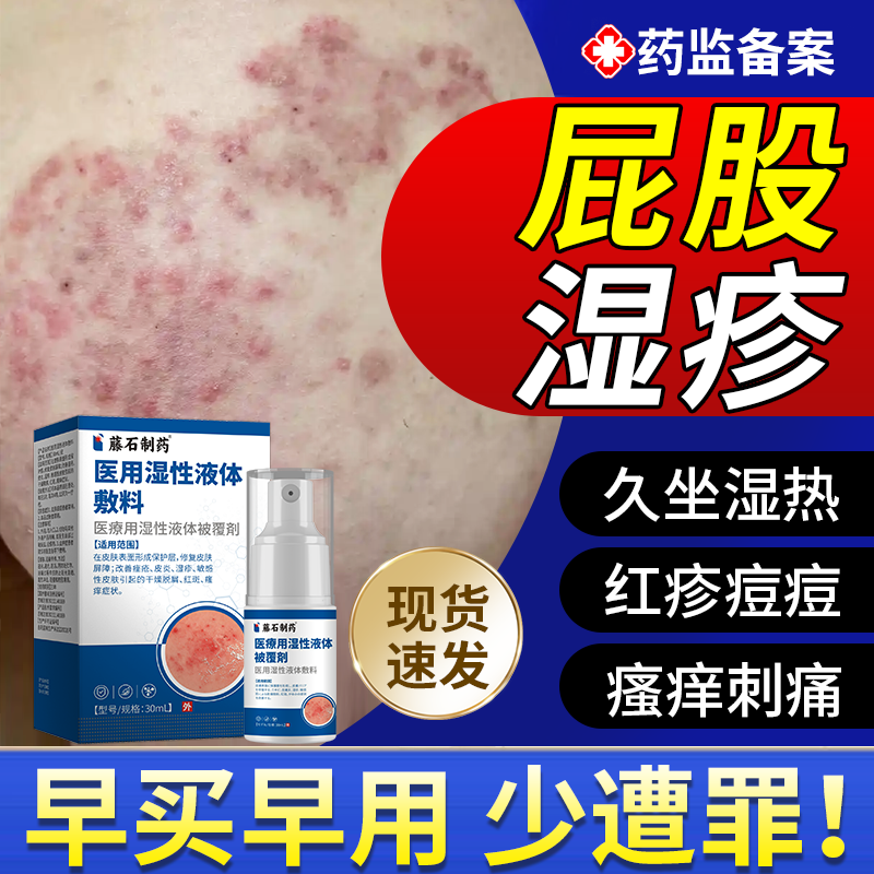 屁股上长痘痘痒起热疙瘩湿疹坐板疮热毒去止痒血热型根热疹喷雾JW