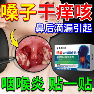 鼻后滴漏喉咙干痒咳嗽嗓子老有痰咽炎慢性咽喉炎异物感搭专用贴OZ