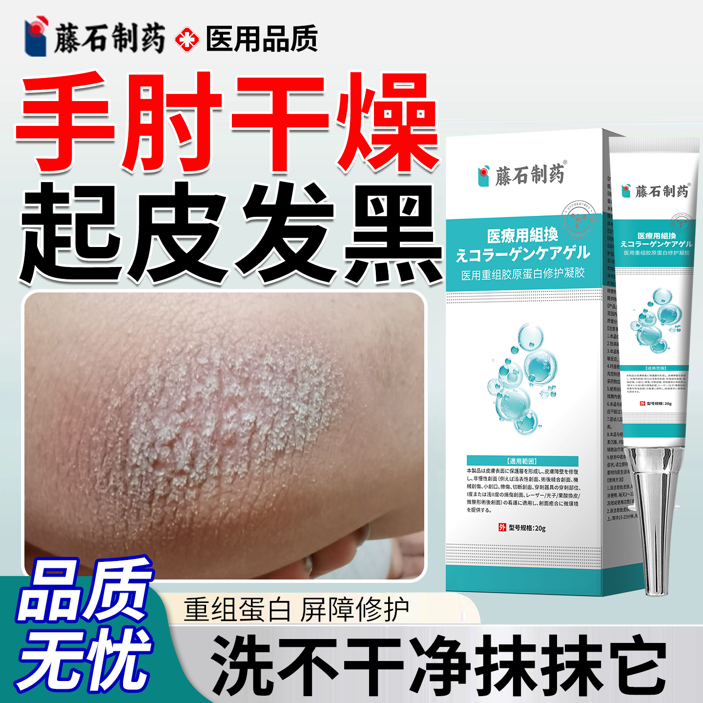手肘胳膊肘干燥起皮癣去黑去死皮神器皮肤黑色素沉淀去除去角质OZ