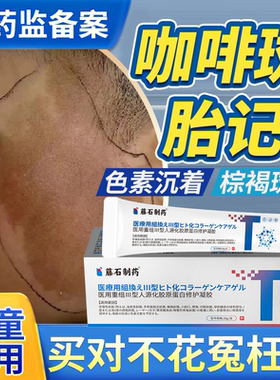 牛奶咖啡斑胎记去除儿童咖啡斑药监备案神经纤维瘤祛斑膏防晒贴EM