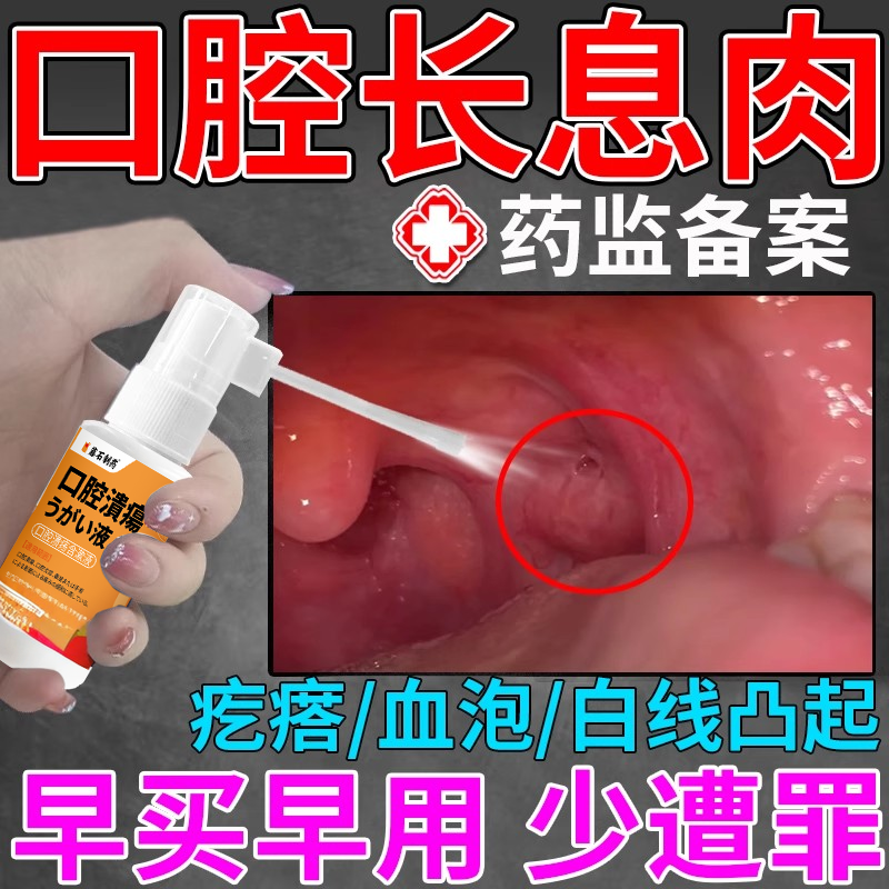 口腔息肉去除乳头状瘤泡疹唾液粘液腺囊肿修复牙龈内壁长肉疙瘩EM
