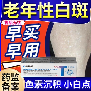 老年性白斑特发性点状手上修老年斑强力去除肤色软膏白斑凝胶复DZ