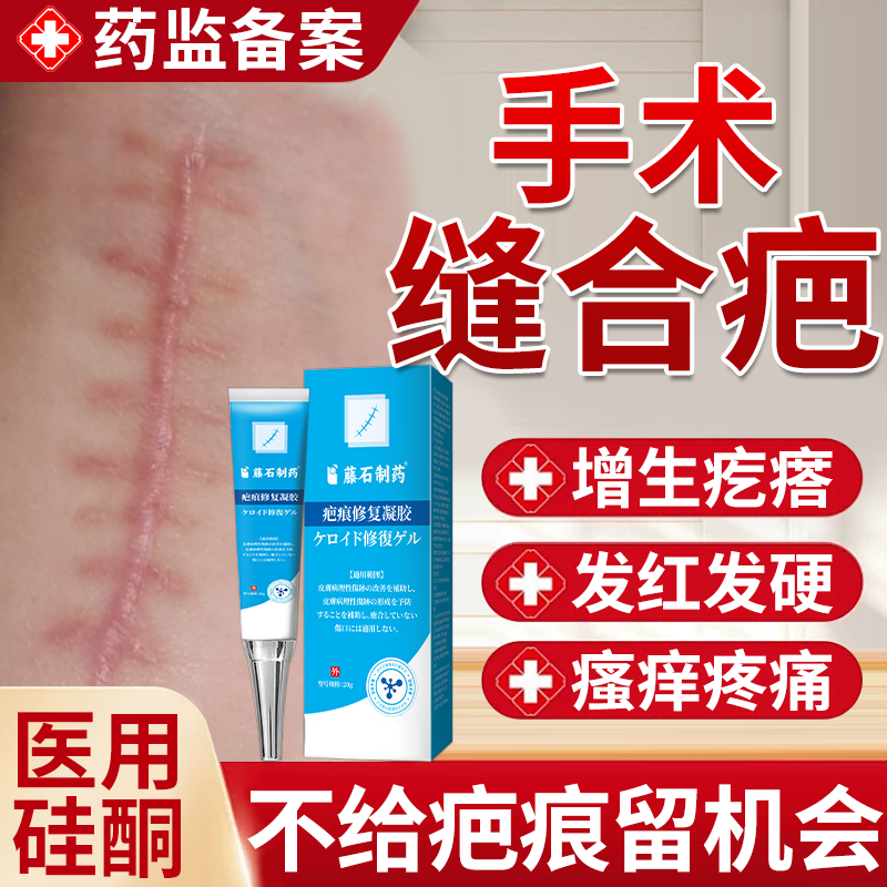手术缝针疤痕刀疤伤疤术后修复去疤伤口刀口专用硅酮除疤祛疤膏JW