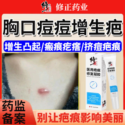 胸口痘痘增生疤痕凸起疙瘩
