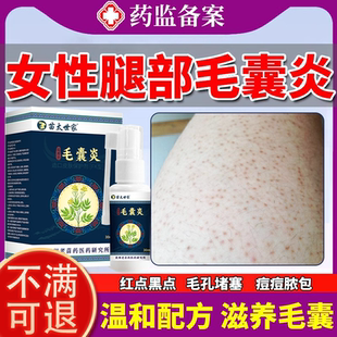 腿部毛囊炎噴劑大腿上長紅疙瘩紅疹小痘痘毛周角化癥雞皮膚OZ