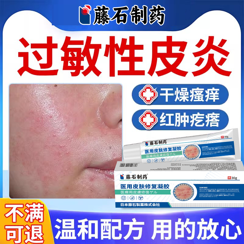 【过敏性皮炎】脸干痒红专用膏