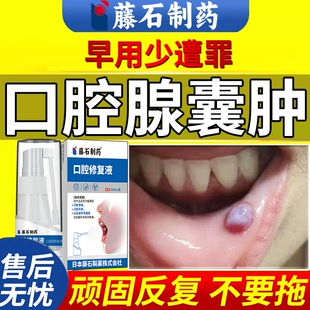 口腔肉疙瘩黏膜粘液腺囊肿唾液腺舌下腺牙龈瘤息肉去除藤石制药DZ