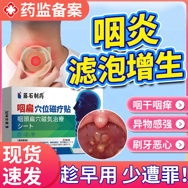滤泡增生慢性咽炎咽喉炎除咽后壁淋巴根用咽喉肿胀异物感膏药贴JW