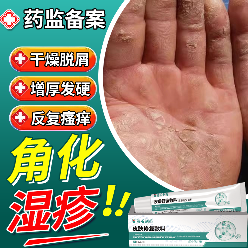 【直击角化型湿疹】不满意随时退