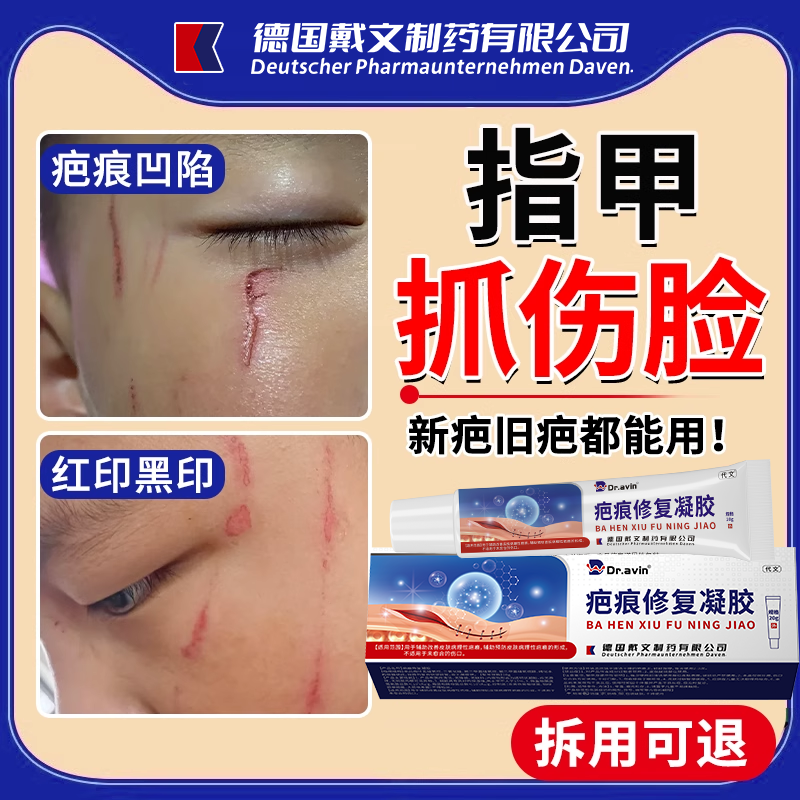 【药房同款】指甲抓伤疤痕祛疤膏