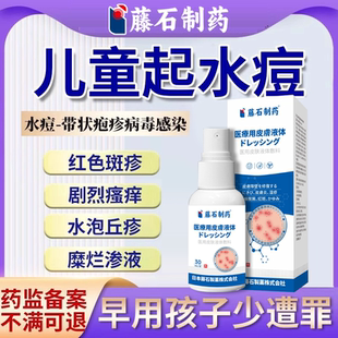 儿童水痘传染性专用带状疱疹起水泡去可搭配疤痕贴止痒根膏EM