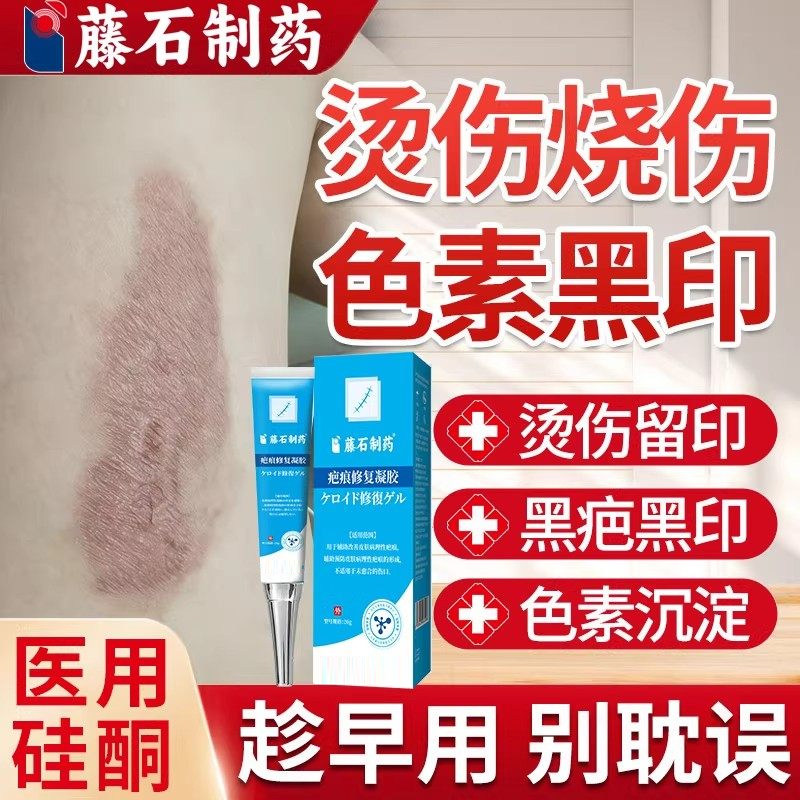 烫伤烧伤疤痕修复除疤膏去黑印色素沉淀油烫伤淡化疤印去伤疤WQ