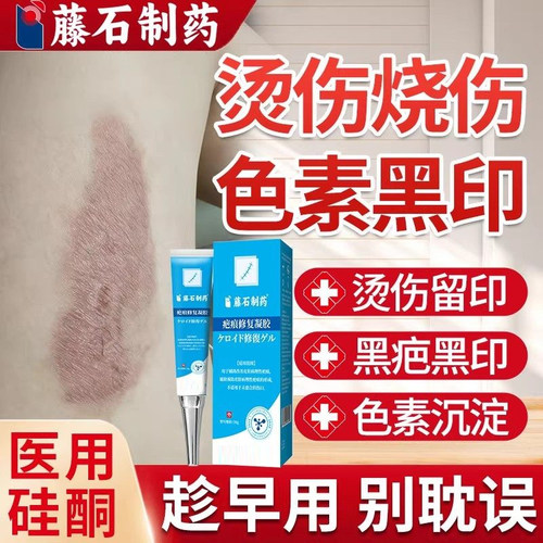 烫伤烧伤疤痕修复除疤膏去黑印