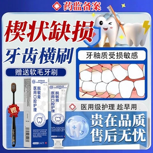 牙齿楔状缺损修补修复牙根不外露抗敏腐蚀萎缩可搭牙膏牙釉质YY