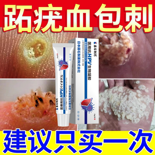 跖疣专用膏去足部脚底病毒疣连根血胞刺去除拔寻常疣拓蚩尤脚上YY