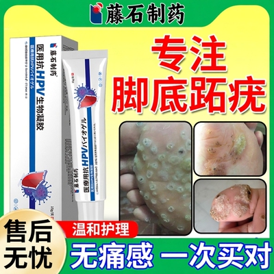 【现货速发】脚底长跖疣适用