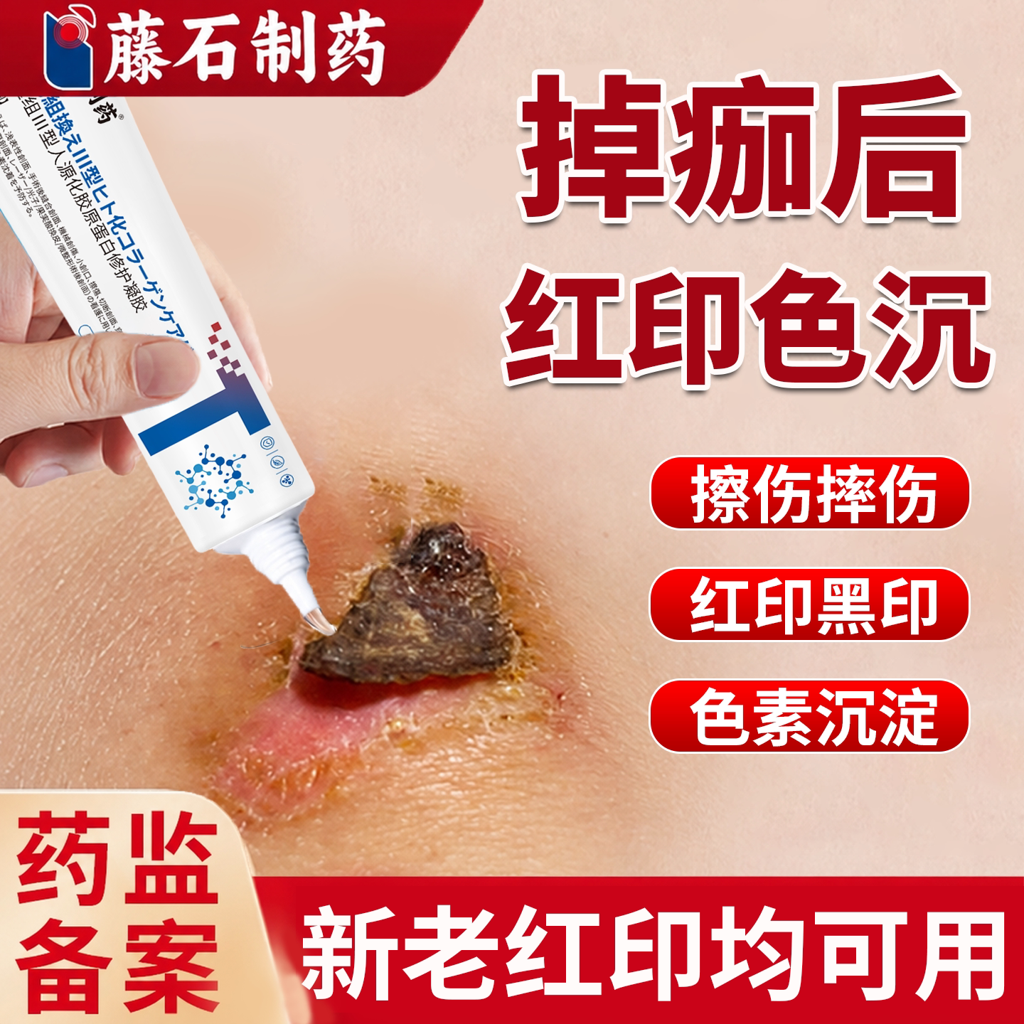 掉痂后红印重组Ⅲ型胶原蛋白凝胶图片