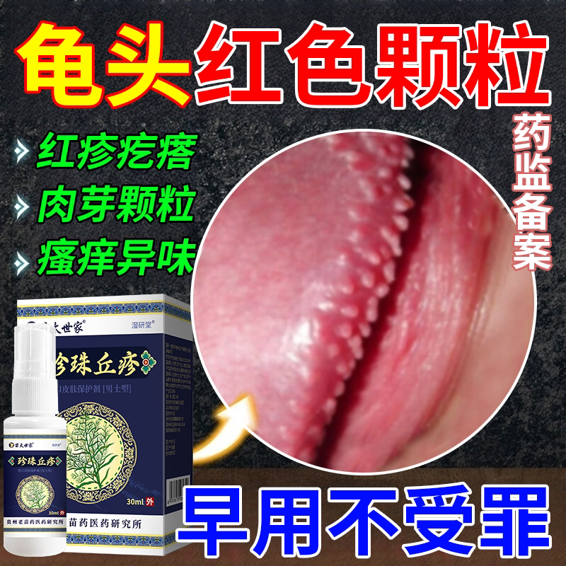 龟头红色颗粒龟头皮水泡下面阴茎珍珠丘疹冠状沟珍珠疹疙瘩去除wy