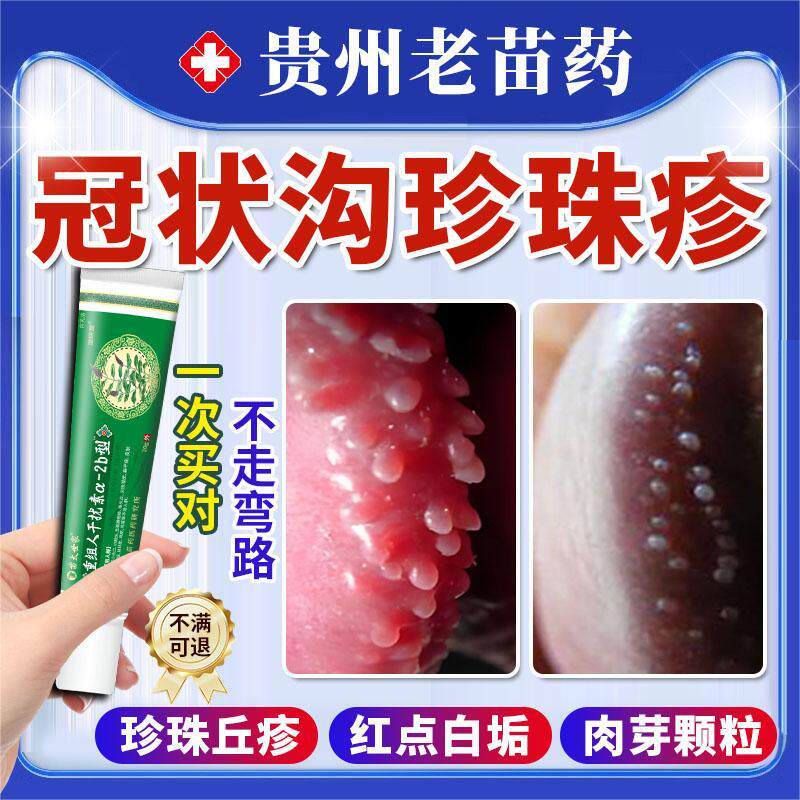 冠状沟龟头粒疹珍珠疹珍珠状阴茎丘疹去除可搭药膏用珍珠软膏ro