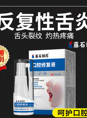 舌炎舌头专用喷雾地图舌裂纹有齿痕舌苔白厚舌康灵萎缩性舌炎YM