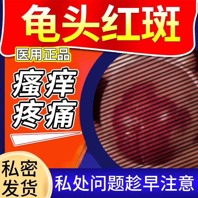 龟头炎龟头上有红斑小红点专用红肿不是药膏疼痛糜烂瘙痒脱皮wyd