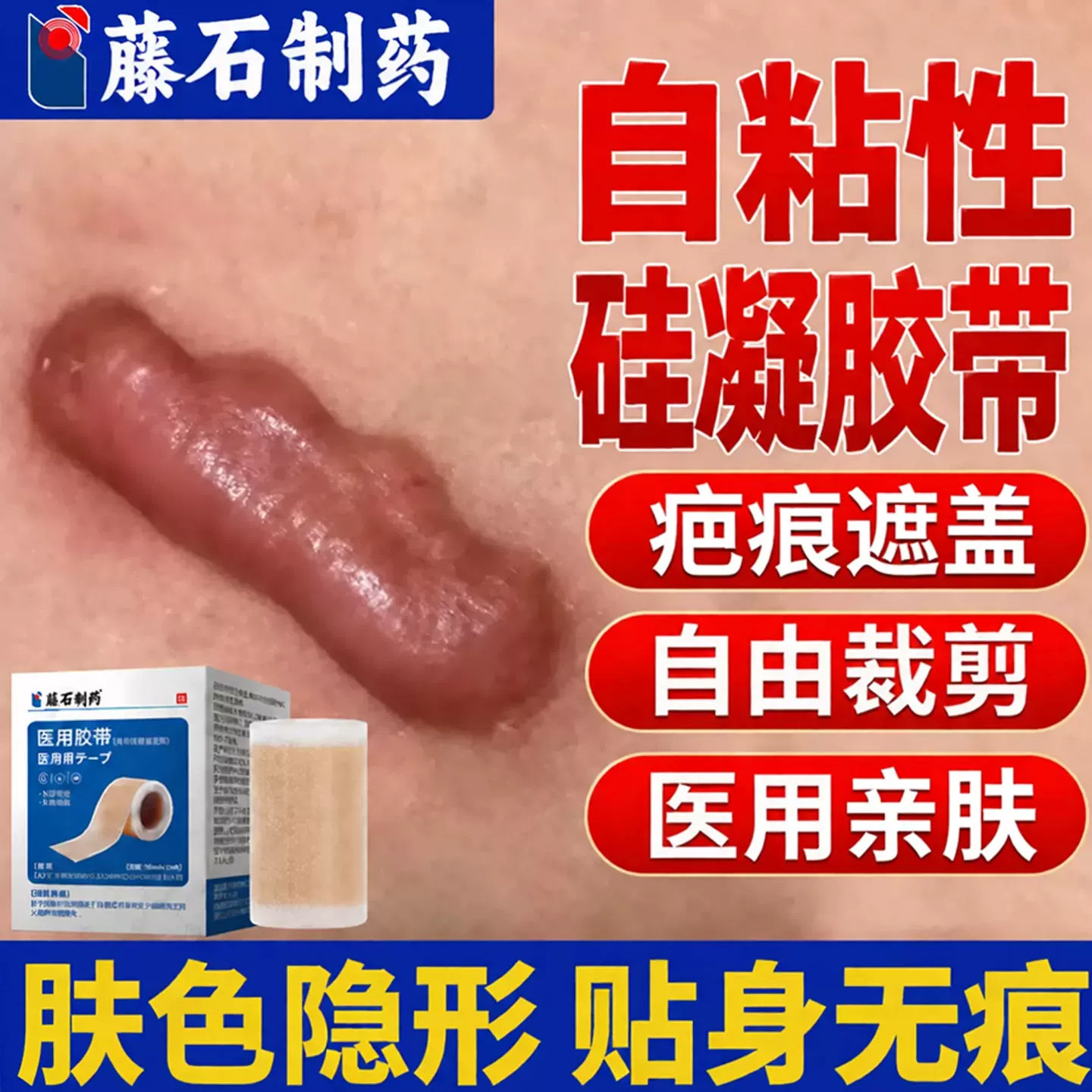 自粘性硅胶带医用遮盖贴加压力肤色隐形贴YZ