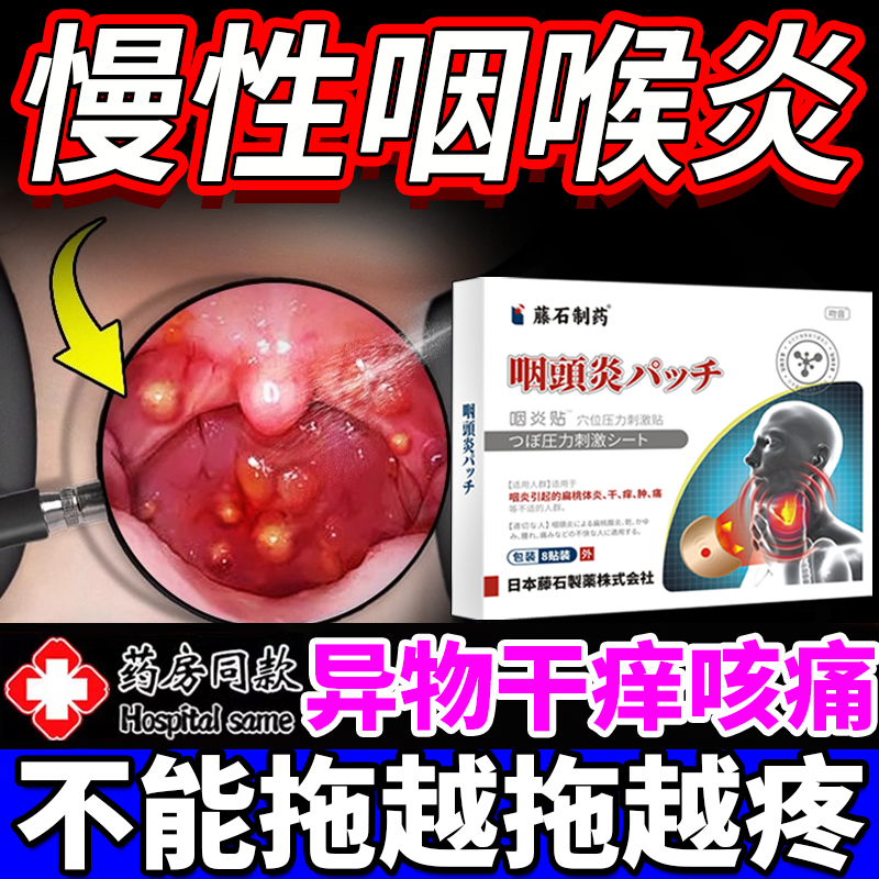 咽喉炎慢性咽炎咽炎除专用根有痰异物感膏药贴喉咙嗓子干痒咳嗽EK