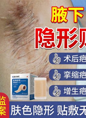 淮海医用硅凝胶带腋下疤痕隐形贴